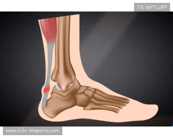 运动损伤补偿机制逐步建立，保障运动参与者合法权益。